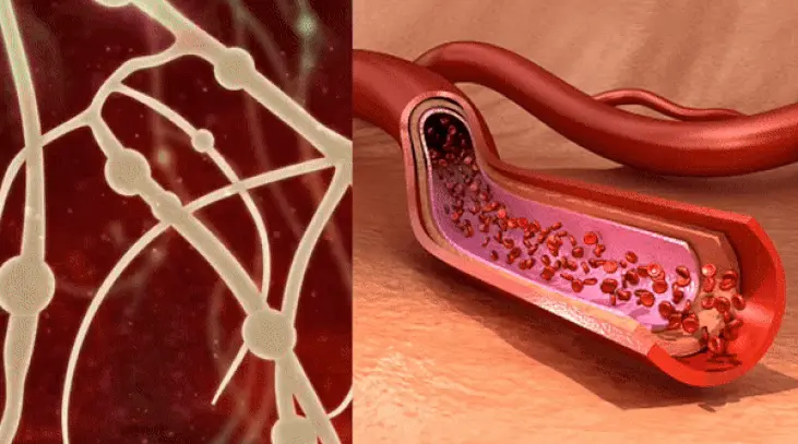 neuropathy gif